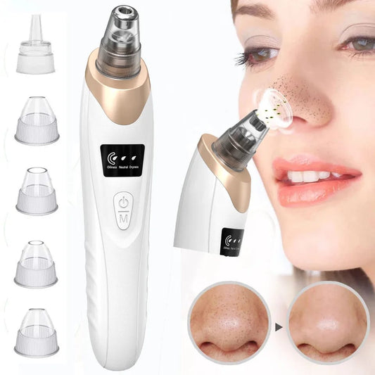 5-in-1 Rechargeable Blackhead Remover – Deep Pore Cleaning & Skin Rejuvenation