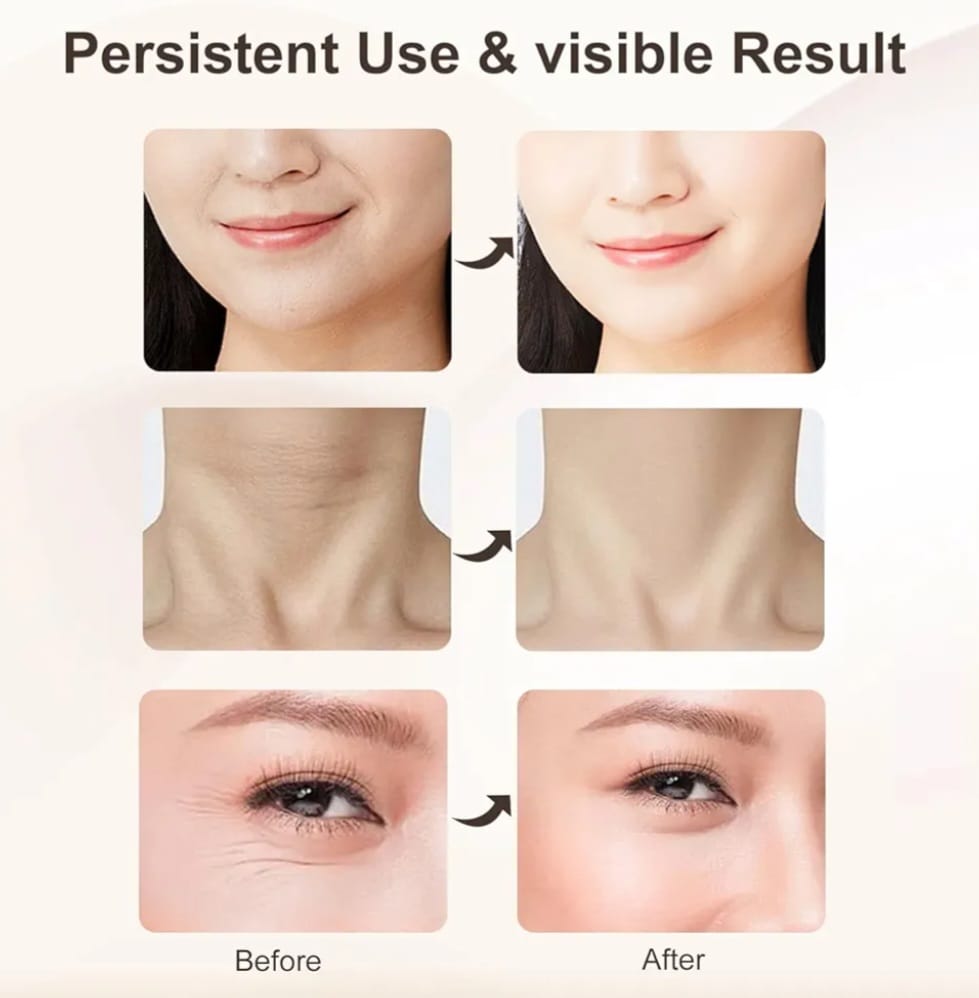 FACE AND NECK MASSAGER